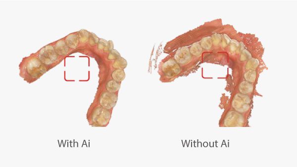 Aoralscan 3 escaner oral