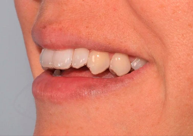 modelos dentales