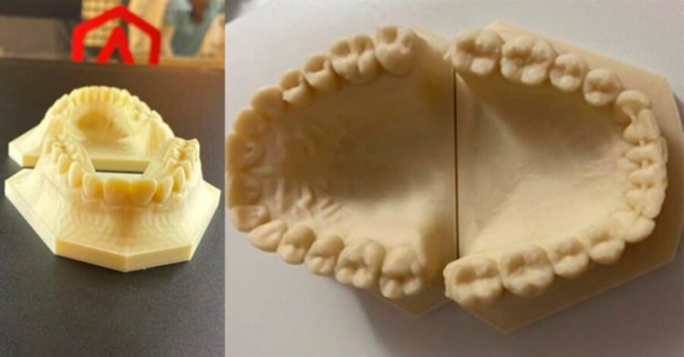 impresora 3d ortodoncia