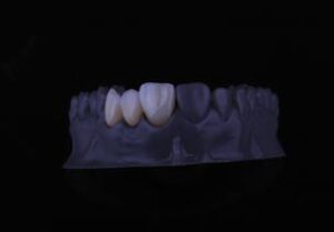 laboratorio odontologico laboratorio 3d dental