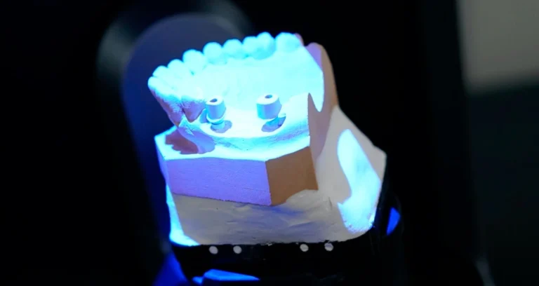 AutoScan-DS-MIX-Shining-escaner dental 3d DENTAL 3D MARKET application