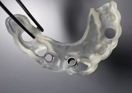 cirugía guiada para implantes dentales