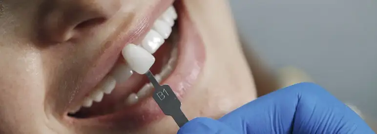 implantes dentales impresoras 3D