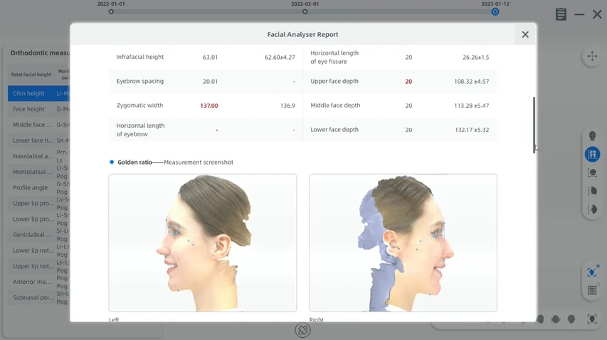 Escáner 3D Facial MetiSmile
