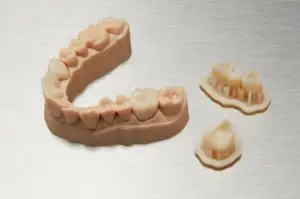 Impresión 3D de prótesis
