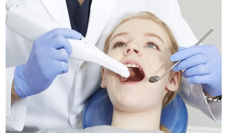 Escáner Dental Intraoral