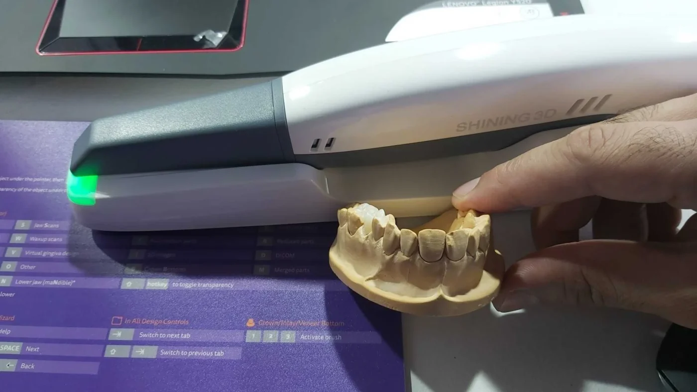 Escáner Digital Dental