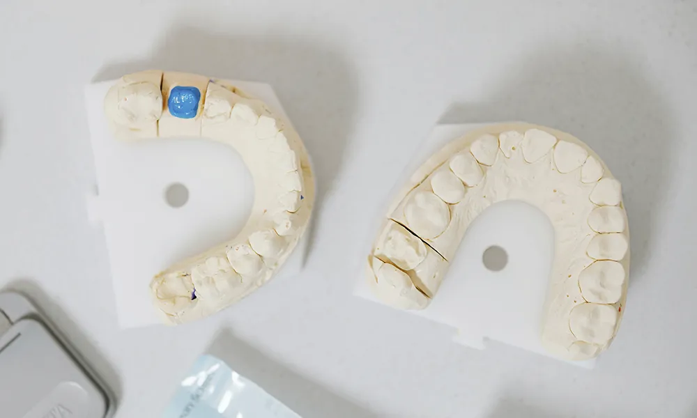 impresora 3d odontología