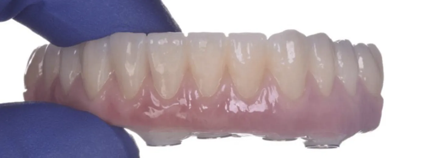 Rehabilitación con impresión 3D