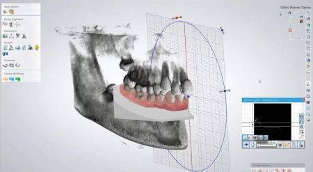 Software Dental Formlabs